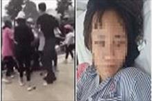 Nữ sinh Quảng Ninh nhập viện vì bị đánh hội đồng